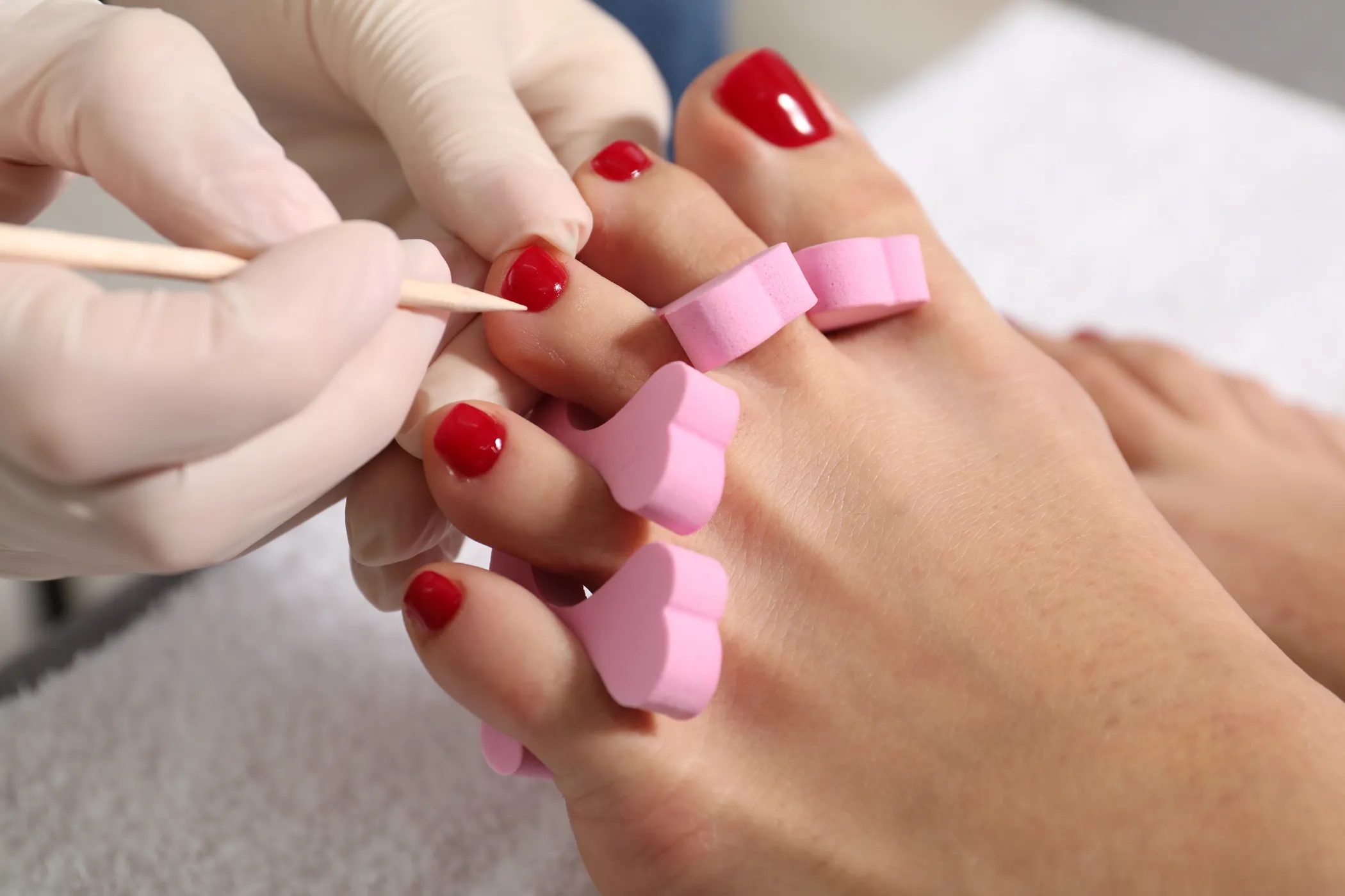 Behandlung am Fuß mit Handschuhen und Zehentrennern, Nägel frisch lackiert.